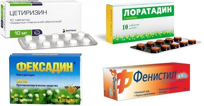 allergiya-na-krasku-dlya-volos-kak-proyavlyaetsya-i-chto-delat9
