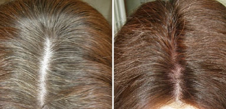 Чем покрасить седые волосы если аллергия на краску для волос